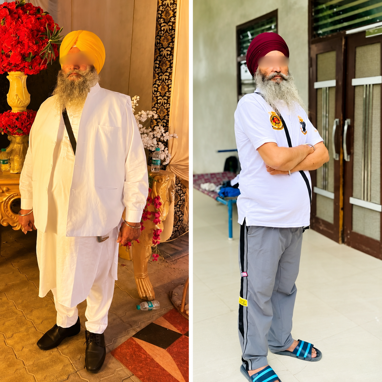 Before and after weight loss surgery - patient transformation