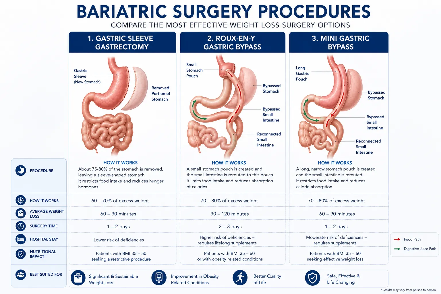 Comparison of bariatric surgery procedures including gastric sleeve and gastric bypass