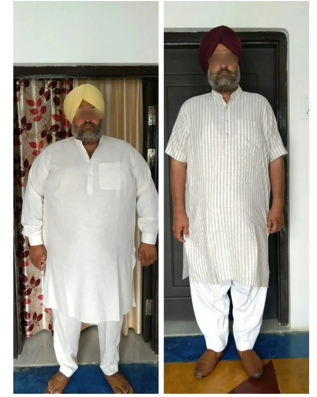 Before and after weight loss journey