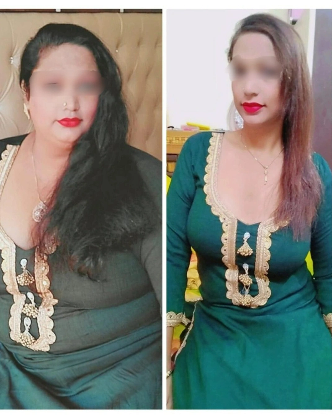 Patient lost 25 kg in 3 months — 135 kg to 110 kg